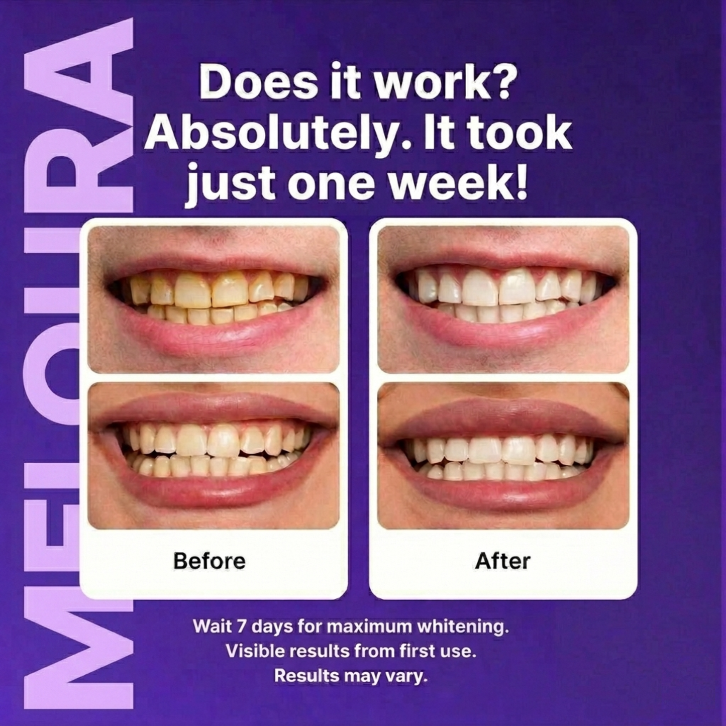 Meloura Purple Teeth Whitening Strips