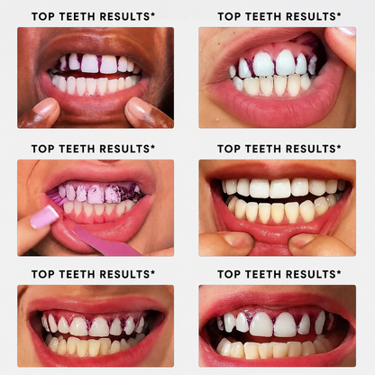 Meloura Purple Whitening Strips