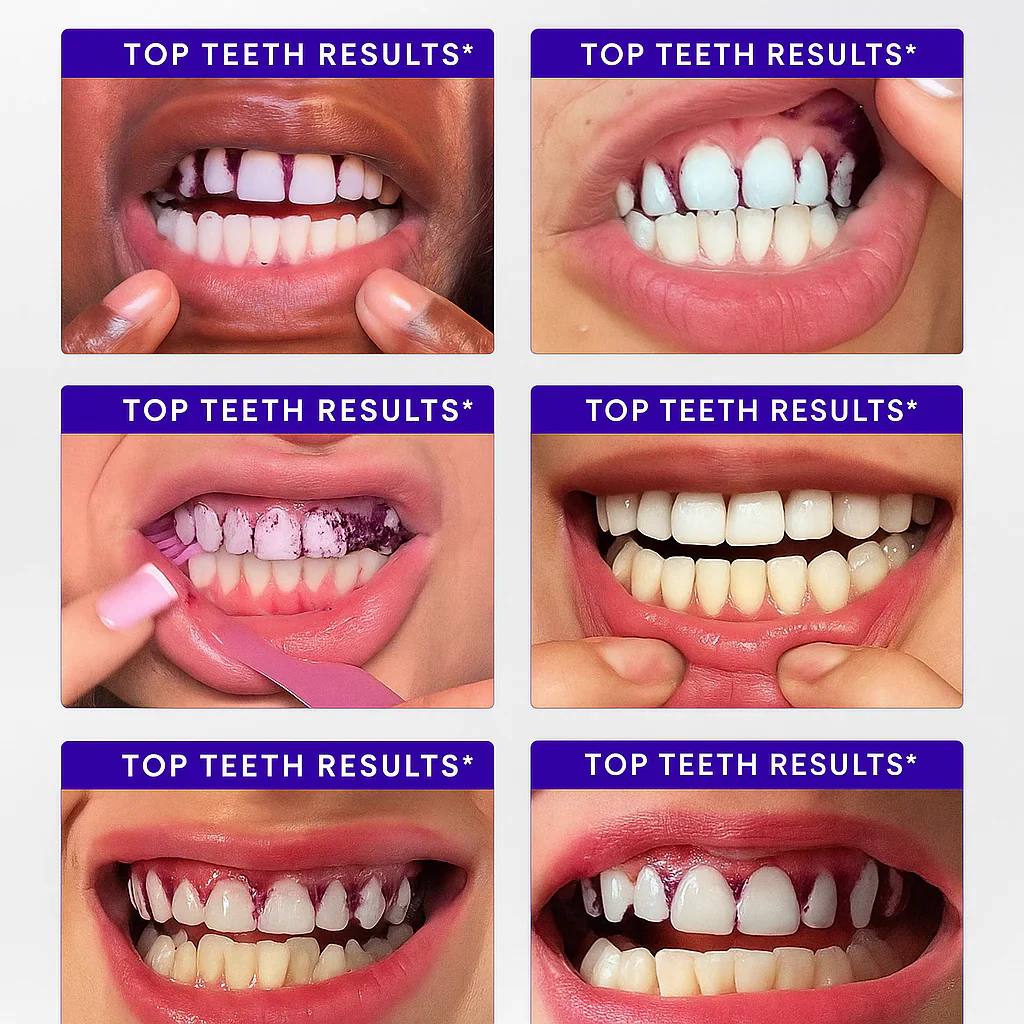 Meloura Purple Teeth Whitening Strips