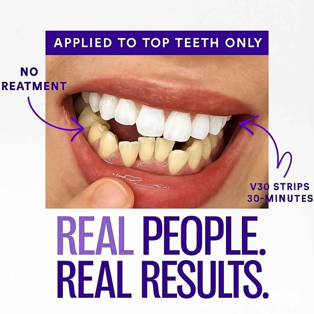 Meloura Purple Teeth Whitening Strips